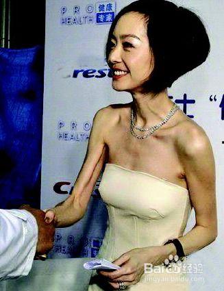 娱乐圈明星快速减肥,娱乐圈减肥达人速效瘦身攻略